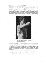 giornale/PUV0110166/1920/unico/00000088