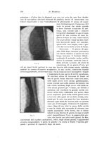 giornale/PUV0110166/1920/unico/00000602