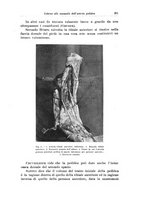 giornale/PUV0110166/1923/V.7/00000287