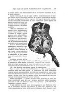 giornale/PUV0110166/1923/V.8/00000065