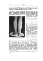 giornale/PUV0110166/1923/V.8/00000466