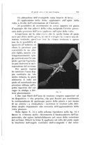 giornale/PUV0110166/1925/V.13/00000731