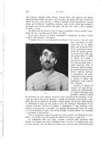 giornale/PUV0110166/1926/V.17/00000292