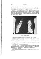 giornale/PUV0110166/1927/V.20/00000294
