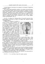 giornale/PUV0110166/1928/V.22/00000061