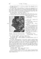 giornale/PUV0110166/1928/V.22/00000312
