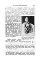 giornale/PUV0110166/1928/V.22/00000613
