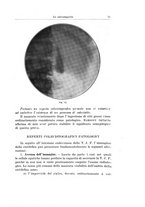 giornale/PUV0110166/1929/V.25/00000085