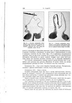 giornale/PUV0110166/1929/V.25/00000152