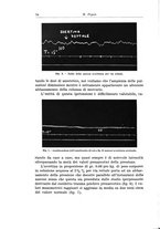 giornale/PUV0110166/1937/V.45/00000084