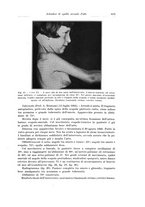 giornale/PUV0110166/1937/V.45/00000643