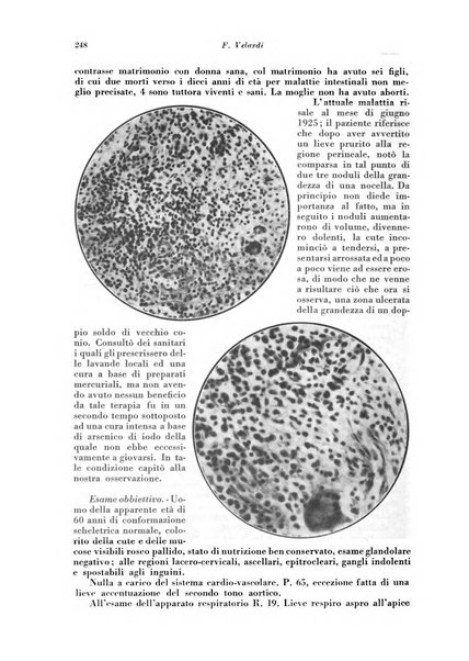 Rivista di patologia e clinica della tubercolosi organo ufficiale della Società italiana fascista di studi scientifici sulla tubercolosi