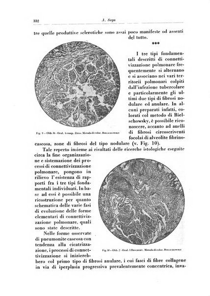 Rivista di patologia e clinica della tubercolosi organo ufficiale della Società italiana fascista di studi scientifici sulla tubercolosi