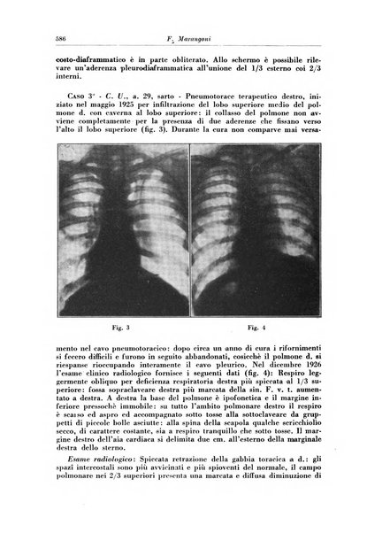 Rivista di patologia e clinica della tubercolosi organo ufficiale della Società italiana fascista di studi scientifici sulla tubercolosi