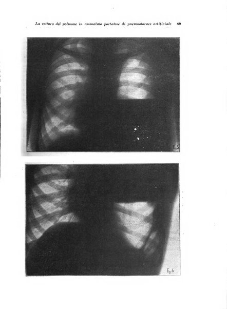 Rivista di patologia e clinica della tubercolosi organo ufficiale della Società italiana fascista di studi scientifici sulla tubercolosi