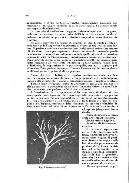 Rivista di patologia e clinica della tubercolosi organo ufficiale della Società italiana fascista di studi scientifici sulla tubercolosi