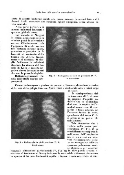 Rivista di patologia e clinica della tubercolosi organo ufficiale della Società italiana fascista di studi scientifici sulla tubercolosi