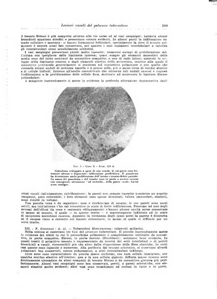 Rivista di patologia e clinica della tubercolosi organo ufficiale della Società italiana fascista di studi scientifici sulla tubercolosi