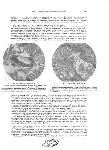 Rivista di patologia e clinica della tubercolosi organo ufficiale della Società italiana fascista di studi scientifici sulla tubercolosi