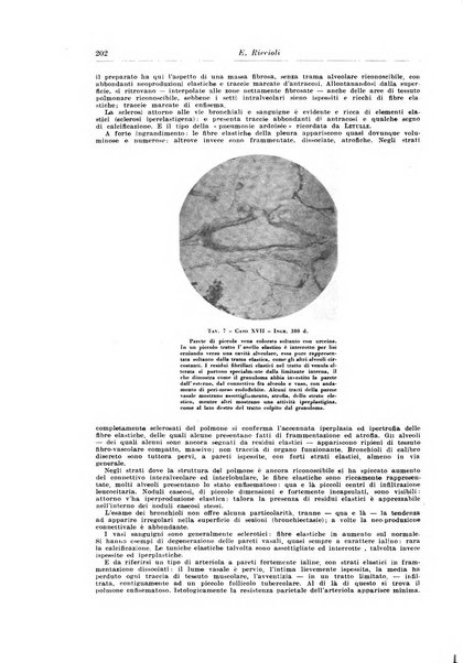 Rivista di patologia e clinica della tubercolosi organo ufficiale della Società italiana fascista di studi scientifici sulla tubercolosi