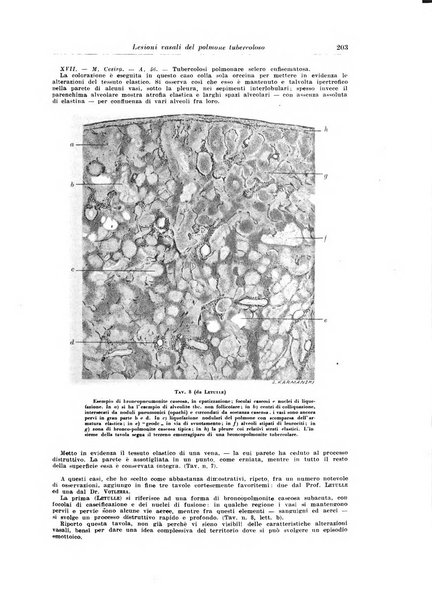 Rivista di patologia e clinica della tubercolosi organo ufficiale della Società italiana fascista di studi scientifici sulla tubercolosi