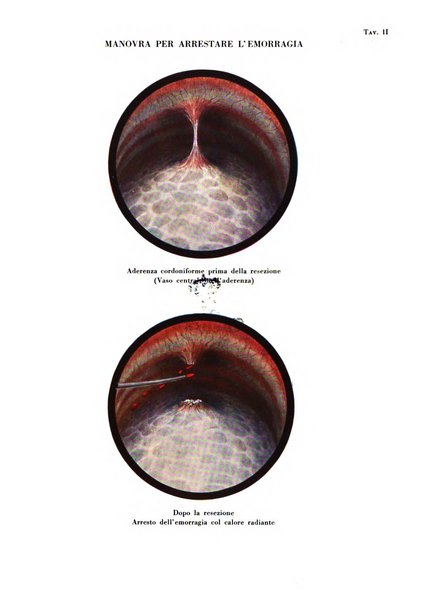 Rivista di patologia e clinica della tubercolosi organo ufficiale della Società italiana fascista di studi scientifici sulla tubercolosi