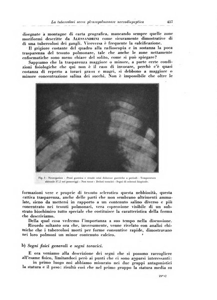 Rivista di patologia e clinica della tubercolosi organo ufficiale della Società italiana fascista di studi scientifici sulla tubercolosi