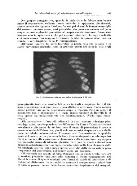 Rivista di patologia e clinica della tubercolosi organo ufficiale della Società italiana fascista di studi scientifici sulla tubercolosi