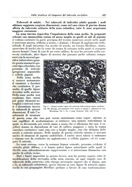 Rivista di patologia e clinica della tubercolosi organo ufficiale della Società italiana fascista di studi scientifici sulla tubercolosi