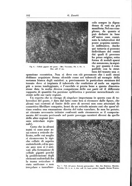 Rivista di patologia e clinica della tubercolosi organo ufficiale della Società italiana fascista di studi scientifici sulla tubercolosi