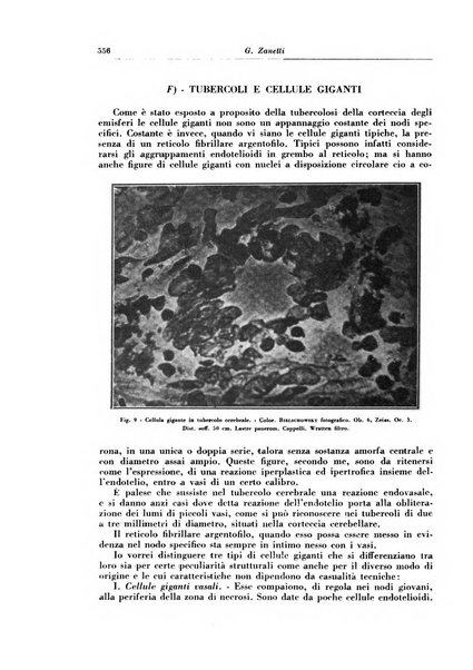 Rivista di patologia e clinica della tubercolosi organo ufficiale della Società italiana fascista di studi scientifici sulla tubercolosi