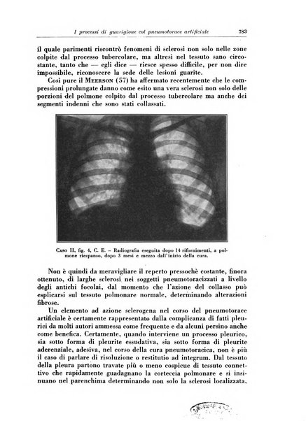 Rivista di patologia e clinica della tubercolosi organo ufficiale della Società italiana fascista di studi scientifici sulla tubercolosi