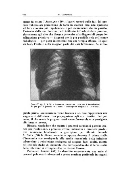 Rivista di patologia e clinica della tubercolosi organo ufficiale della Società italiana fascista di studi scientifici sulla tubercolosi