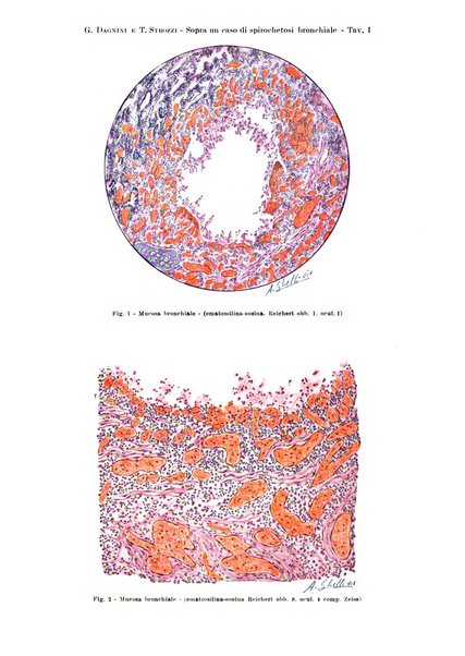 Rivista di patologia e clinica della tubercolosi organo ufficiale della Società italiana fascista di studi scientifici sulla tubercolosi