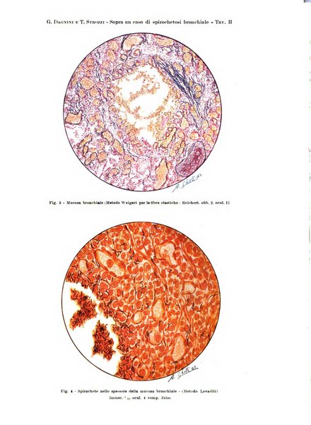 Rivista di patologia e clinica della tubercolosi organo ufficiale della Società italiana fascista di studi scientifici sulla tubercolosi