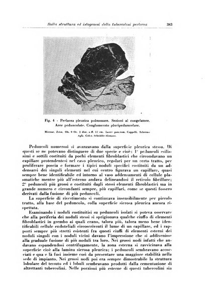 Rivista di patologia e clinica della tubercolosi organo ufficiale della Società italiana fascista di studi scientifici sulla tubercolosi