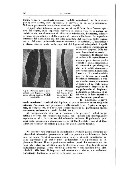 Rivista di patologia e clinica della tubercolosi organo ufficiale della Società italiana fascista di studi scientifici sulla tubercolosi