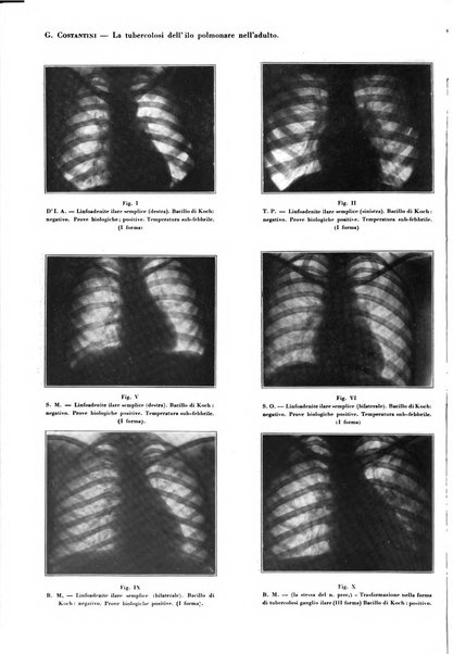 Rivista di patologia e clinica della tubercolosi organo ufficiale della Società italiana fascista di studi scientifici sulla tubercolosi