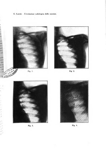 Rivista di patologia e clinica della tubercolosi organo ufficiale della Società italiana fascista di studi scientifici sulla tubercolosi