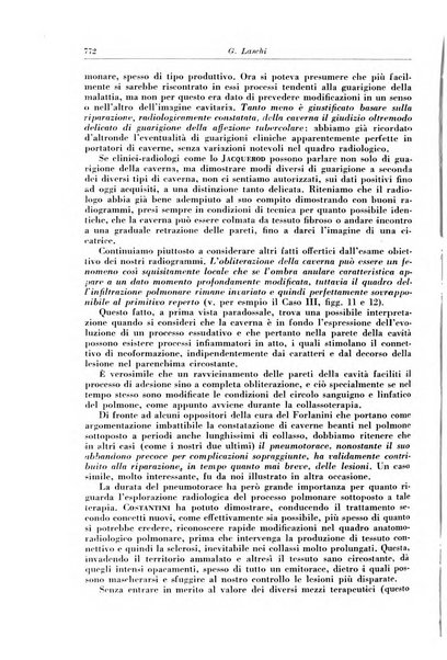 Rivista di patologia e clinica della tubercolosi organo ufficiale della Società italiana fascista di studi scientifici sulla tubercolosi