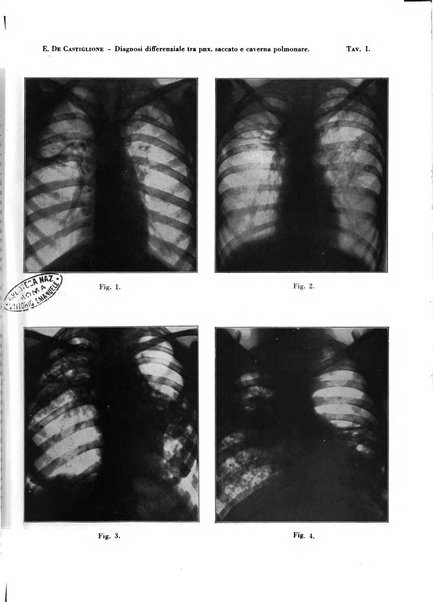 Rivista di patologia e clinica della tubercolosi organo ufficiale della Società italiana fascista di studi scientifici sulla tubercolosi