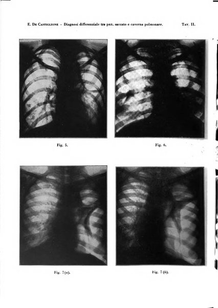 Rivista di patologia e clinica della tubercolosi organo ufficiale della Società italiana fascista di studi scientifici sulla tubercolosi