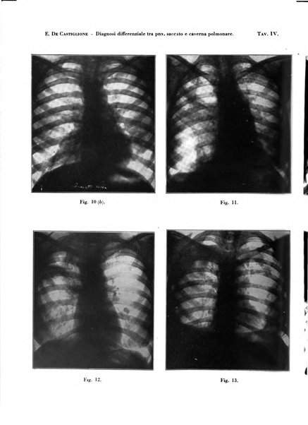 Rivista di patologia e clinica della tubercolosi organo ufficiale della Società italiana fascista di studi scientifici sulla tubercolosi