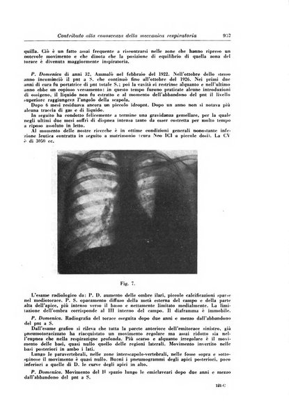 Rivista di patologia e clinica della tubercolosi organo ufficiale della Società italiana fascista di studi scientifici sulla tubercolosi