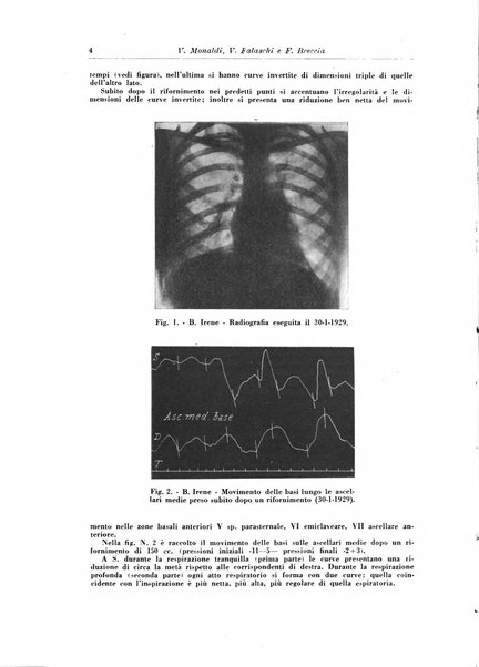 Rivista di patologia e clinica della tubercolosi organo ufficiale della Società italiana fascista di studi scientifici sulla tubercolosi