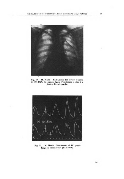 Rivista di patologia e clinica della tubercolosi organo ufficiale della Società italiana fascista di studi scientifici sulla tubercolosi