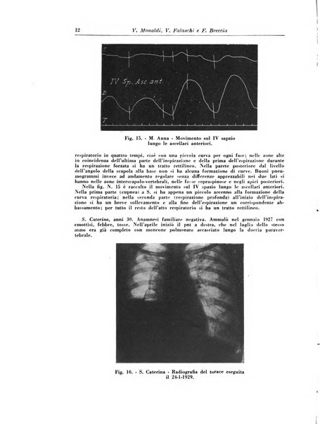 Rivista di patologia e clinica della tubercolosi organo ufficiale della Società italiana fascista di studi scientifici sulla tubercolosi