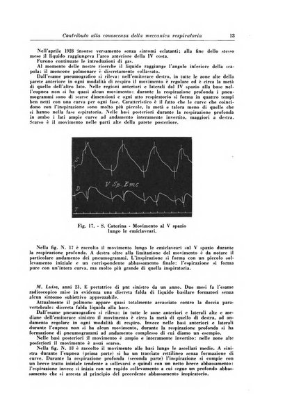 Rivista di patologia e clinica della tubercolosi organo ufficiale della Società italiana fascista di studi scientifici sulla tubercolosi