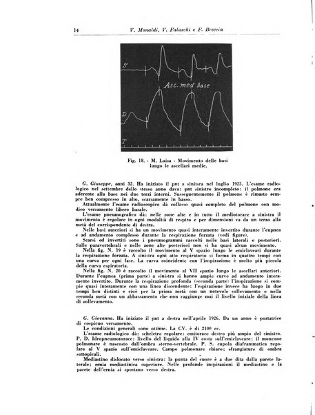 Rivista di patologia e clinica della tubercolosi organo ufficiale della Società italiana fascista di studi scientifici sulla tubercolosi