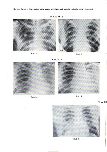 Rivista di patologia e clinica della tubercolosi organo ufficiale della Società italiana fascista di studi scientifici sulla tubercolosi